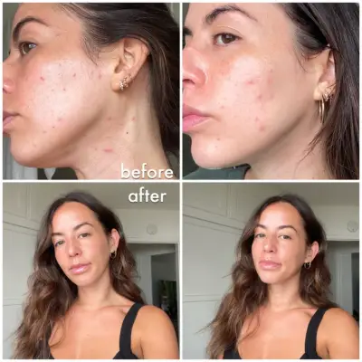 SkinMedica TNS Ceramide Treatment Cream Editor Review