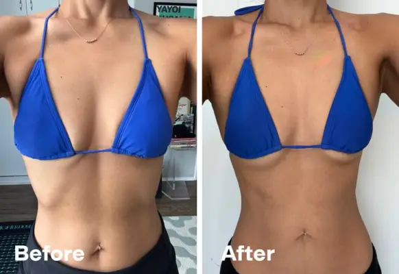  DMK Enzyme Natural Boob Lift before and after 