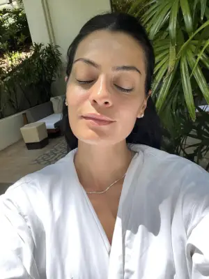 After the non-surgical lift facial